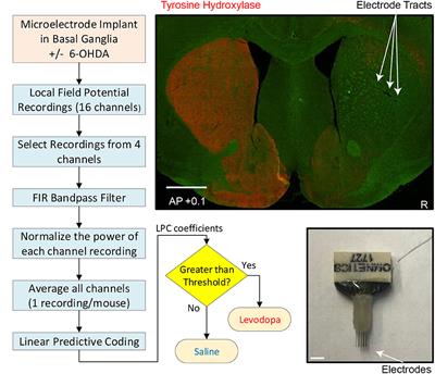 Linear Predictive Approaches Separate Field Potentials in Animal Model of Parkinson's Disease